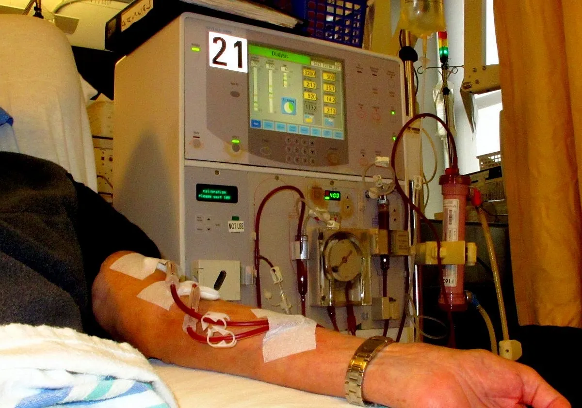 A patient's arm connected by blood lines to a hemodialysis machine during a treatment
